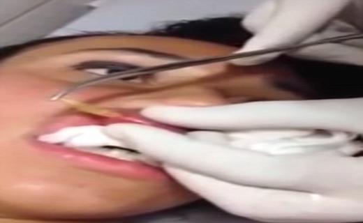 کرم زنده ای که در لب دختر جوان جا خوش کرده بود (+عکس) 